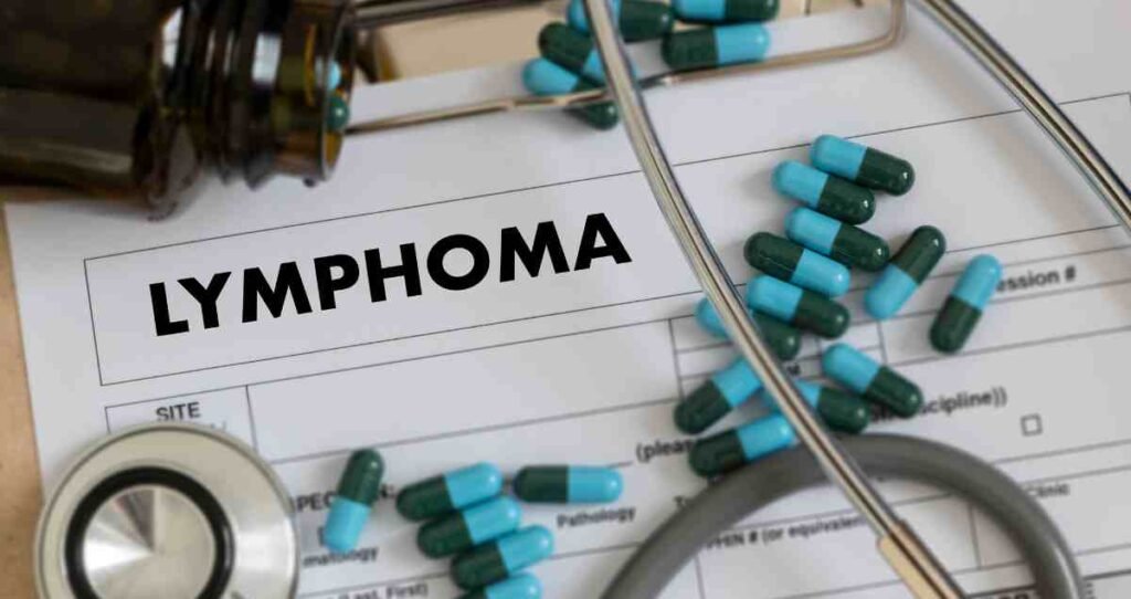 Lymphoma Treatment