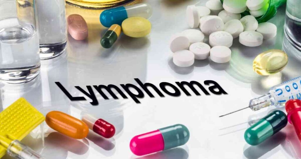 Lymphoma Treatment